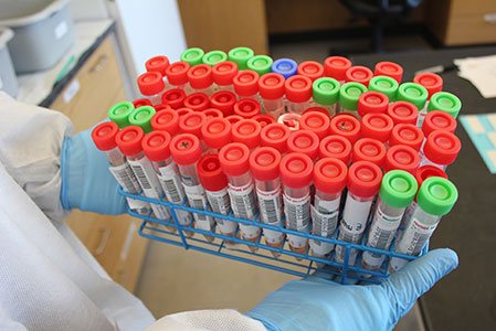 Vials containing specimens that SHL tested for influenza on Jan. 22 are organized in a tray. These 72 specimens represent a high volume of influenza activity and testing that dramatically increased in Iowa during the month of January.