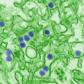Digitally-colorized transmission electron micrograph (TEM) of Zika virus.